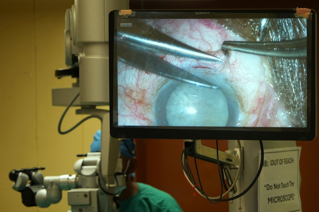 A monitor displays a live cataract surgery during a surgical marathon, in Tsakane, South Africa, Saturday, March 28, 2026. (AP Photo/Kayleen Morgan)