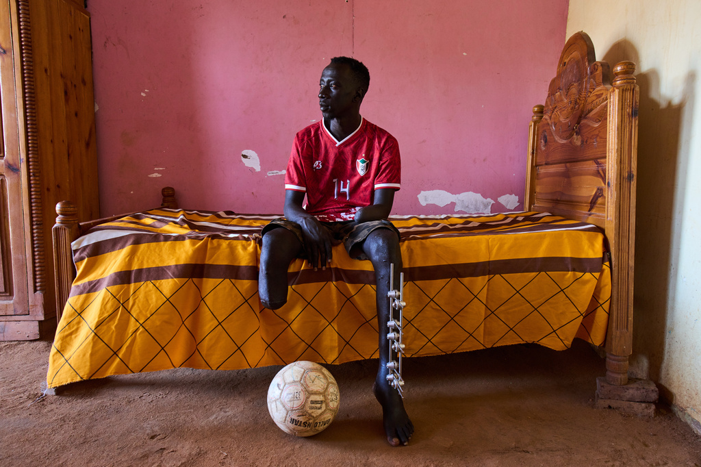 Omer al-Toum, 33, who lost his leg and arm by the explosion of unexploded ordnance, sits in his bedroom in Bahri, on the outskirts of Khartoum, Thursday, April 23, 2026. (AP Photo/Bernat Armangue)