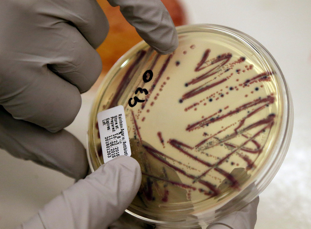 FILE - A microbiologist points out an isolated E. coli growth on an agar plate at the Washington State Department of Health, Nov. 3, 2015, in Shoreline, Wash. (AP Photo/Elaine Thompson, File)