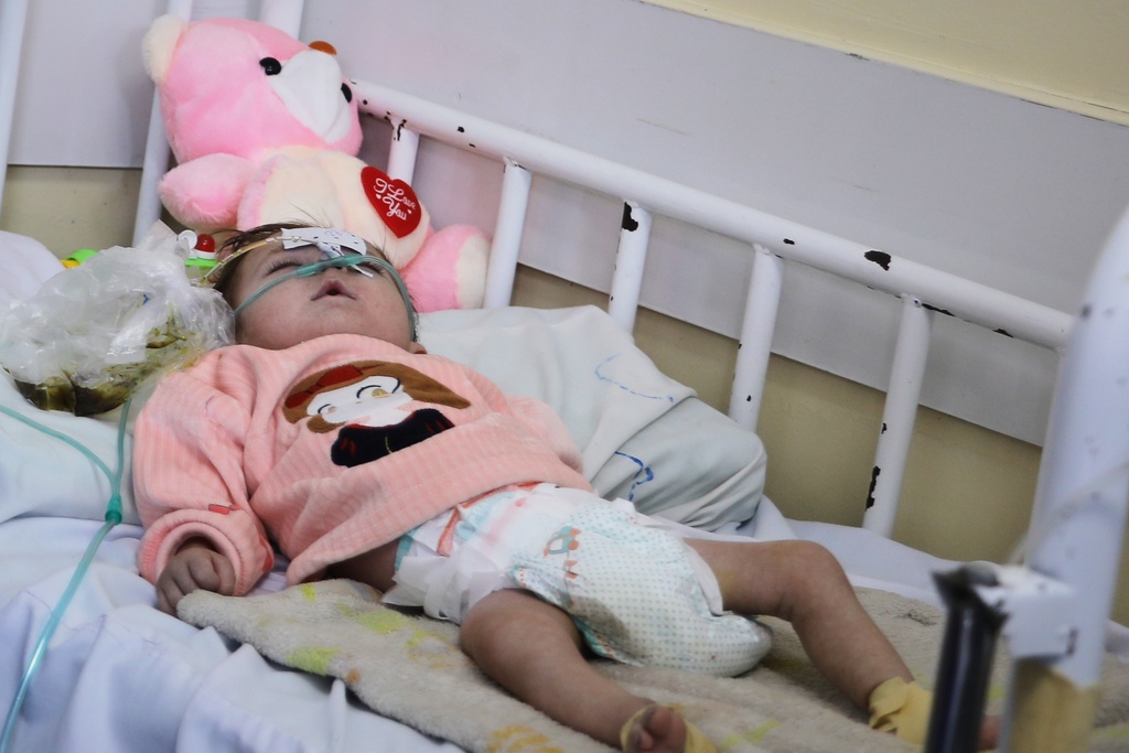 Samir, a 6-month-old from the far northeastern province of Badakhshan who is suffering from a heart condition and severe pneumonia compounded by malnutrition, lies in a hospital bed at Ataturk National Children's Hospital in Kabul, Afghanistan, Sunday, Feb. 15, 2026. (AP Photo/Siddiqullah Alizai)