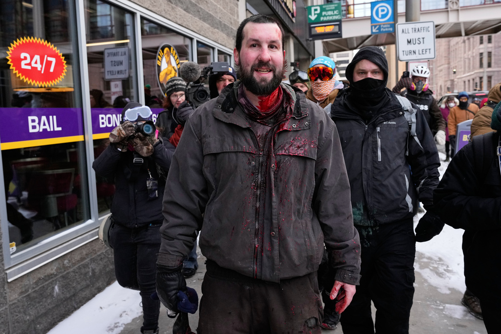 A Jake Lang supporter bleeds from his head as he is chased away by pro-immigration protesters Saturday, Jan. 17, 2026, in Minneapolis. (AP Photo/Yuki Iwamura)