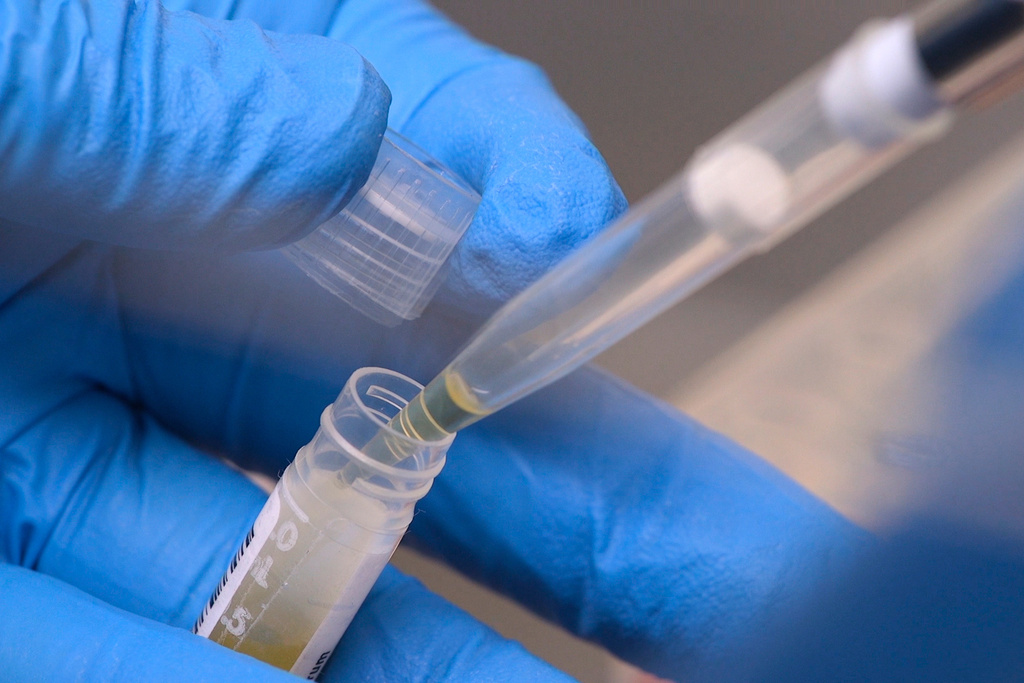 FILE - National Institute of Health researchers test patient samples in Bethesda, Md., on Nov. 20, 2019. (AP Photo/Federica Narancio, File)