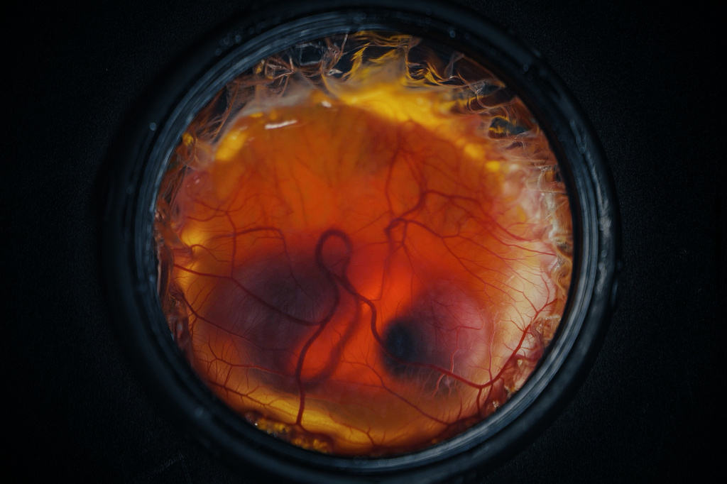 This undated photo provided by Colossal Biosciences shows the embryo of a chick developing inside an artificial environment. (Colossal Biosciences via AP)