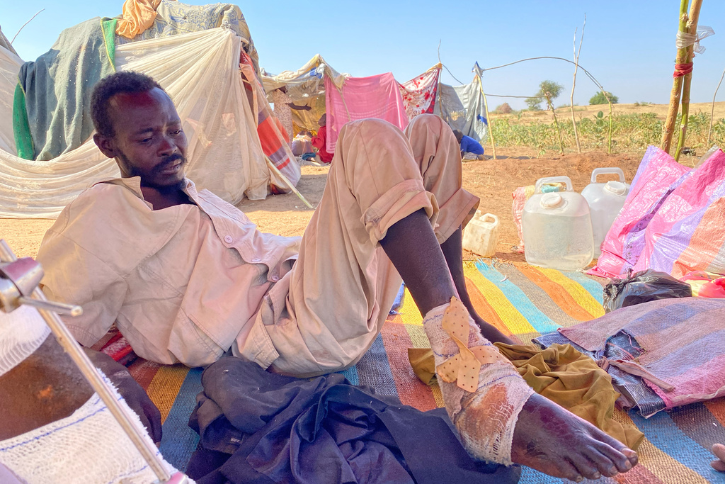Al Shafiea Abdallah Holy, an injured Sudanese who fled el-Fasher city, after Sudan's paramilitary forces killed hundreds of people in the western Darfur region, receives medical care at a camp in Tawila, Sudan, Thursday, Oct. 30, 2025. (AP Photo/Mohammed Abaker)
