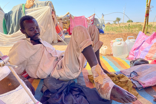 Al Shafiea Abdallah Holy, an injured Sudanese who fled el-Fasher city, after Sudan's paramilitary forces killed hundreds of people in the western Darfur region, receives medical care at a camp in Tawila, Sudan, Thursday, Oct. 30, 2025. (AP Photo/Mohammed Abaker) Al Shafiea Abdallah Holy, an injured Sudanese who fled el-Fasher city, after Sudan's paramilitary forces killed hundreds of people in the western Darfur region, receives medical care at a camp in Tawila, Sudan, Thursday, Oct. 30, 2025. (AP Photo/Mohammed Abaker)