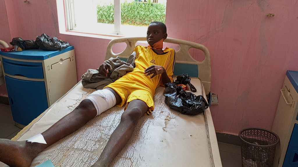 A victim of Monday's bomb blast at a market receives treatment at a hospital in Maiduguri, Nigeria, Tuesday, March 17, 2026. (AP Photo/Jossy Ola)