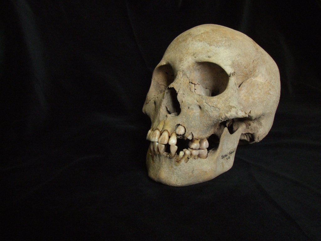 This 2006 image from Angela Lieverse shows the skull of a young girl who was buried with victims of the plague in Siberia. (Angela Lieverse via AP)