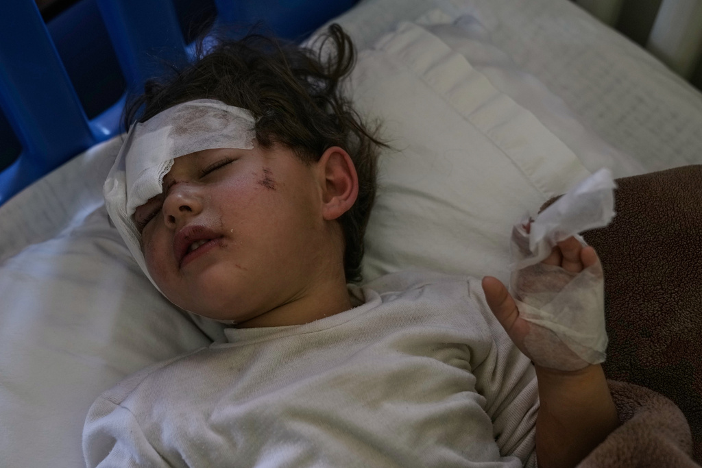 Syrian Menisa Taha, who was wounded in an Israeli airstrike, lies in Rayak Hospital in eastern Lebanon, Saturday, Feb. 21, 2026. (AP Photo/Bilal Hussein)