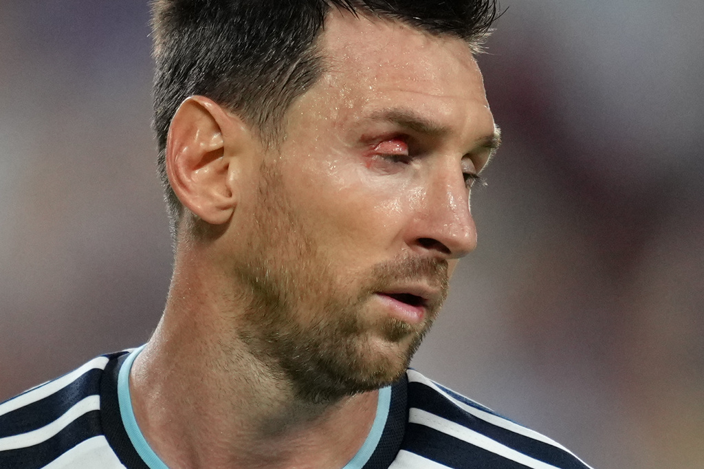 Argentina's Lionel Messi (10) looks on during the World Cup quarterfinal soccer match between Argentina and Switzerland in Kansas City, Mo., Saturday, July 11, 2026. (AP Photo/Ed Zurga)
