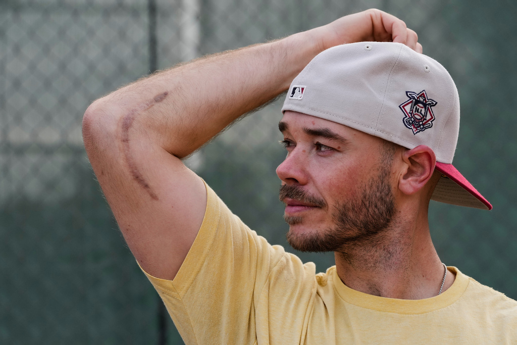 Daulton Jefferies looks at the scar remaining from multiple right elbow surgeries, Saturday, Dec. 13, 2025, in Walnut Creek, Calif. (AP Photo/Godofredo A. Vásquez)