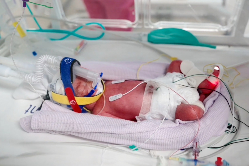 In this image taken from video taken on July 15, 2026, one of the quadruplets born at Metro North Health hospital lies in an incubator in Brisbane, Australia. (Metro North Health via AP)