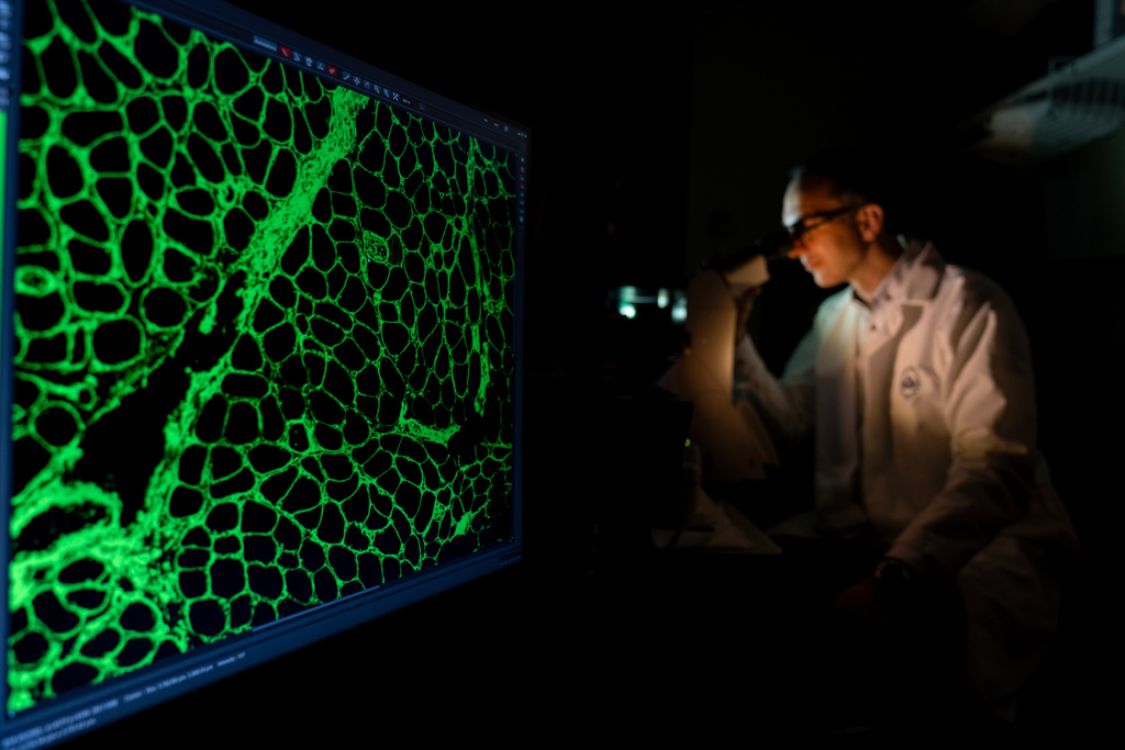 Dr. Iago Pinal-Fernandez, a staff clinician, poses for a portrait while examining cells from a muscle biopsy in a light imaging lab at the National Institutes of Health, Monday, Aug. 25, 2025, in Bethesda, Md. Pinal-Fernandez studies myositis, a group of muscle-weakening autoimmune diseases. "When I started, nothing was known about the type of autoimmune disease we study. Now finally we're able to tell patients, 'You have this disease and this is the mechanism of disease. And this is the reason why we're treating you – because the disease works in this way.'" (AP Photo/David Goldman)