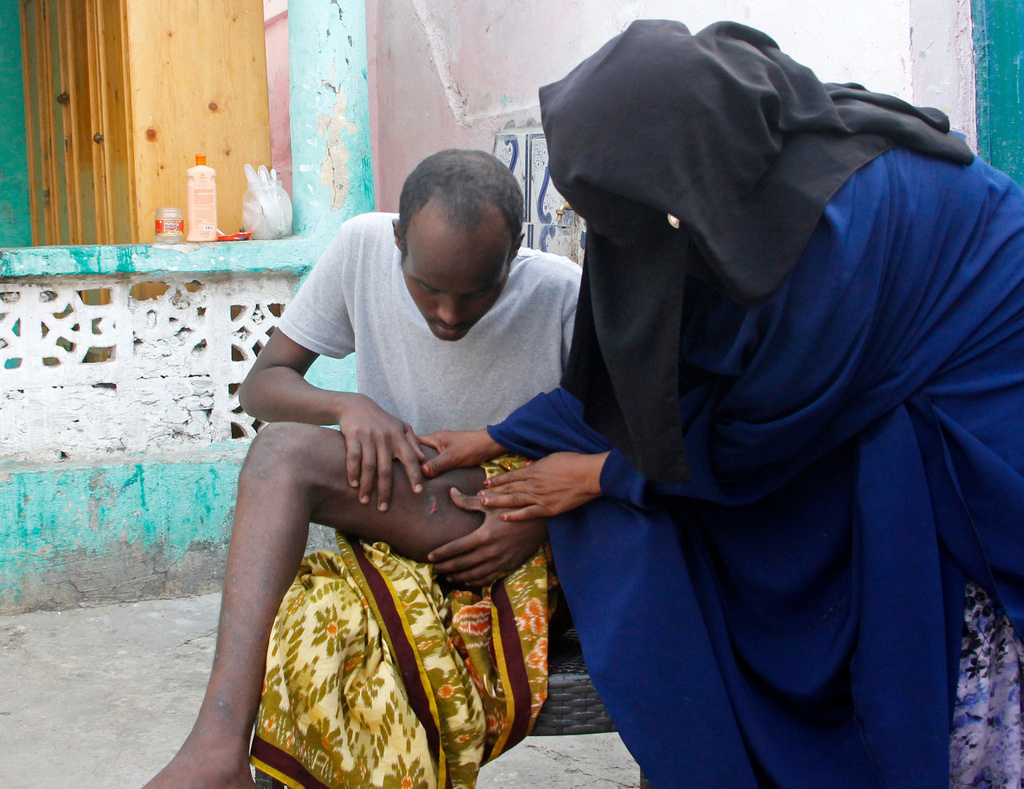 Mohamed Abdi Awale, who says he was captured and tortured by smugglers while attempting to reach Europe, shows his mother wounds during an interview with The Associated Press in Mogadishu, Somalia, Monday, Nov. 17, 2025. (AP Photo/Farah Abdi Warsameh)