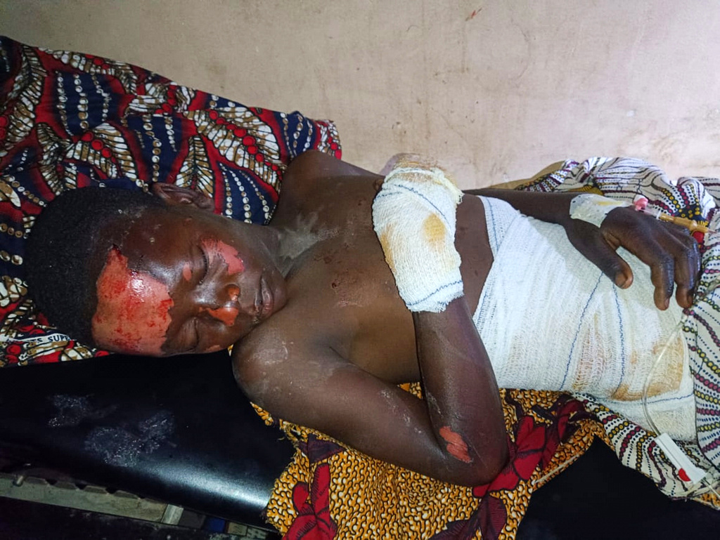 In this photo released by Amnesty International Nigeria, a patient receives treatment at the Yariman Bakura Specialist hospital in Gusau, Nigeria, Monday, May 11, 2026, after a Nigerian military airstrike struck a market on Sunday. (Amnesty International Nigeria Via AP)