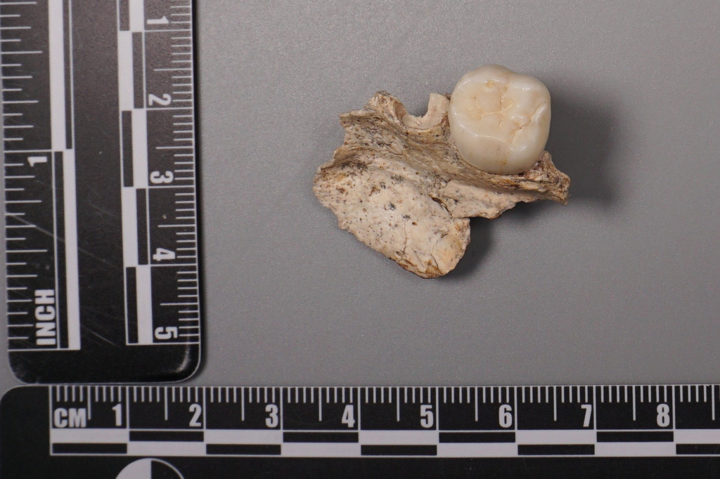 This undated image provided by the Institute of Vertebrate Paleontology and Paleoanthropology, Chinese Academy of Sciences shows an ancient tooth found at the Sunjiadong archaeological site in China. (Kai Zhou/Institute of Vertebrate Paleontology and Paleoanthropology, Chinese Academy of Sciences via AP)