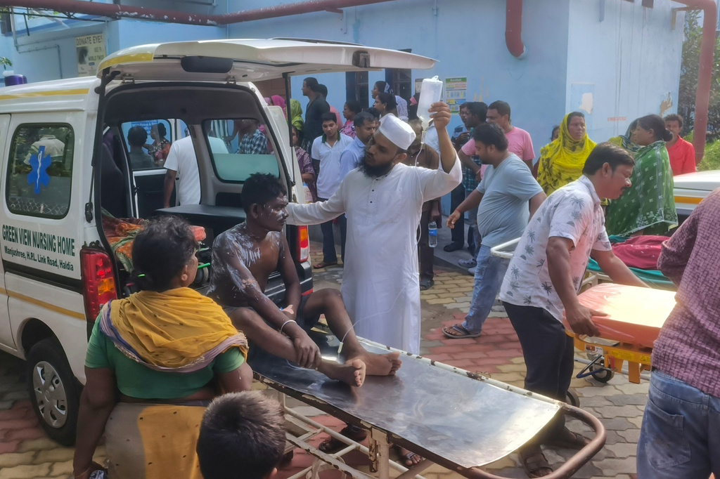 A victim of a fire at a petrochemical plant is brought to a hospital for treatment in Purba Medinipur district, about 130 kilometers (80 miles) southwest of Kolkata, the capital of India's West Bengal state, Tuesday, June 30, 2026. (AP Photo)