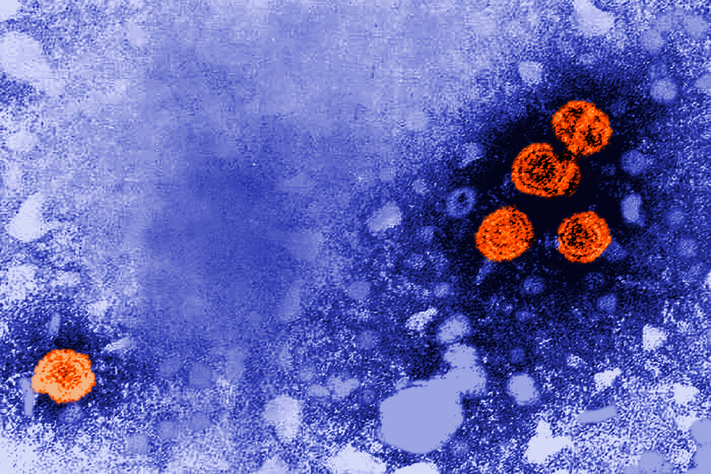 FILE - This 1981 electron microscope image made available by the U.S. Centers for Disease Control and Prevention shows hepatitis B virus particles, indicated in orange. (Dr. Erskine Palmer/CDC via AP, File)