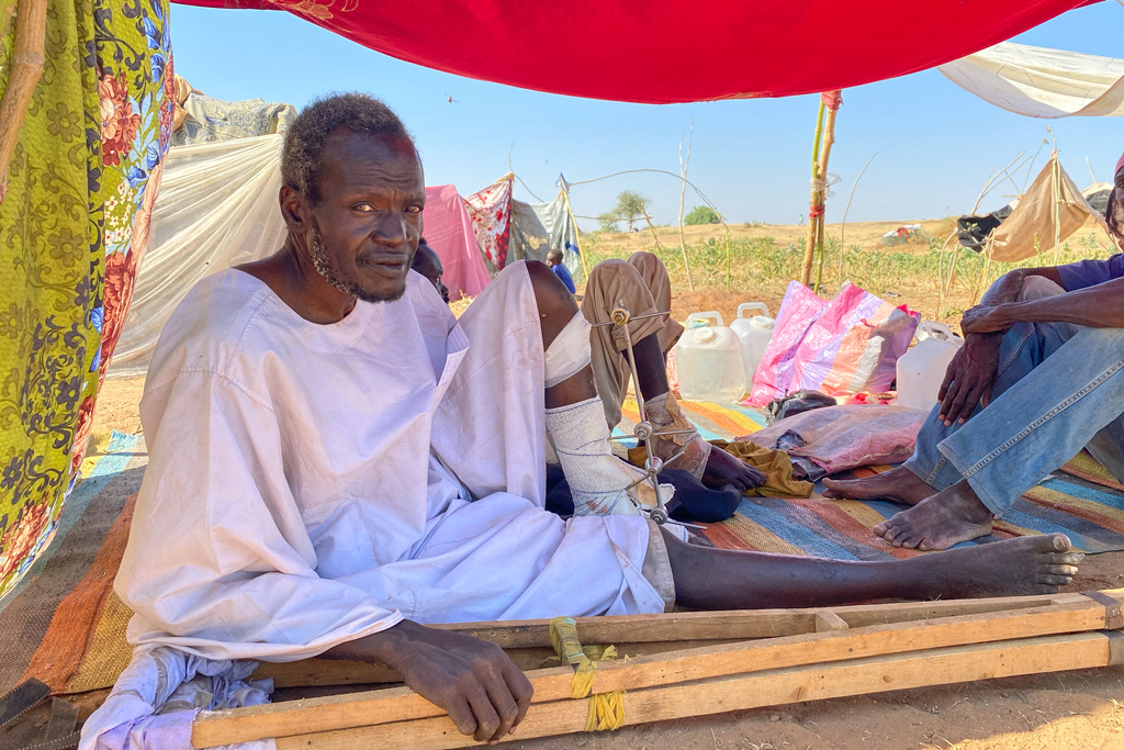 Adam Mohammed Adem, an injured Sudanese who fled el-Fasher city, after Sudan's paramilitary forces killed hundreds of people in the western Darfur region, receives medical care at a camp in Tawila, Sudan, Thursday, Oct. 30, 2025. (AP Photo/Mohammed Abaker)