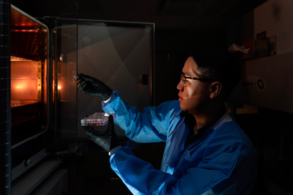 Dr. Justin Kwong, a research fellow, poses for a portrait as he removes cells from an incubator in the lab where he works at the National Institutes of Health, Monday, Aug. 25, 2025, in Bethesda, Md. Kwong coaxes human stem cells to grow into a kind of immune cell involved in autoimmune diseases, and has to replenish batches with fresh nutrients. "These are my babies. It's very rewarding to do this. It's very exciting but difficult to manage. I have to come in every day to feed them. Seven days a week. That's why I have a personal attachment to the cells. It takes a lot of your life, like a baby." (AP Photo/David Goldman)