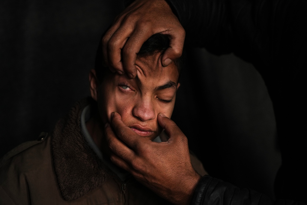 Mahmoud Abu Ishaq, 14, who is suffering vision loss due to a corneal condition, has his eye shown to the camera by his father as they await permission to travel outside the Gaza Strip for medical treatment, in Khan Younis, Gaza Strip, Tuesday, Jan. 27, 2026. (AP Photo/Abdel Kareem Hana)