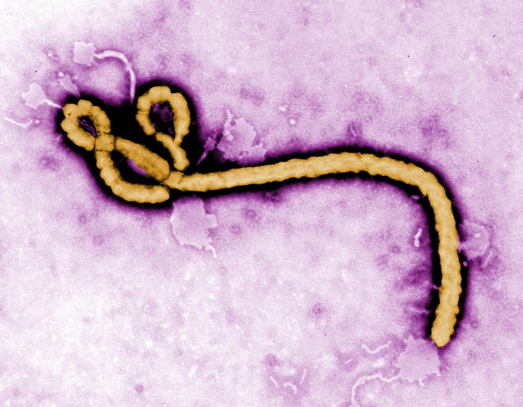 FILE - This undated colorized transmission electron micrograph file image made available by the Centers for Disease Control and Prevention (CDC) shows an Ebola virus virion. (Frederick Murphy/CDC via AP, File)