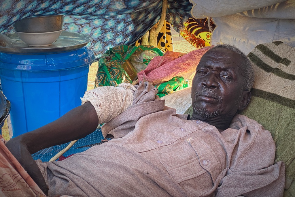 An injured Sudanese man who fled el-Fasher city, after Sudan's paramilitary forces killed hundreds of people in the western Darfur region, rsits in a tent at a camp in Tawila, Sudan, Saturday, Nov. 1, 2025. (AP Photo/Mohammed Bakry)