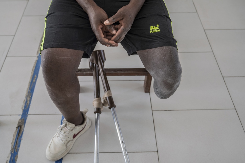 Jerome Jean-Claude Amani, one of many wounded by fighting in the region, waits for his prosthetic leg at an orthopedic center run by the Catholic church and supported by Red Cross in Goma, eastern Congo, Friday, Aug. 29, 2025. (AP Photo/Moses Sawasawa)