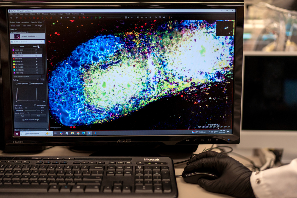 Research fellow Sachin Surwase shows an image of a pancreatic lymph node from a mouse in the lab where he studies autoimmune diseases at Johns Hopkins University in Baltimore, Md., Tuesday, May 13, 2025. (AP Photo/David Goldman)