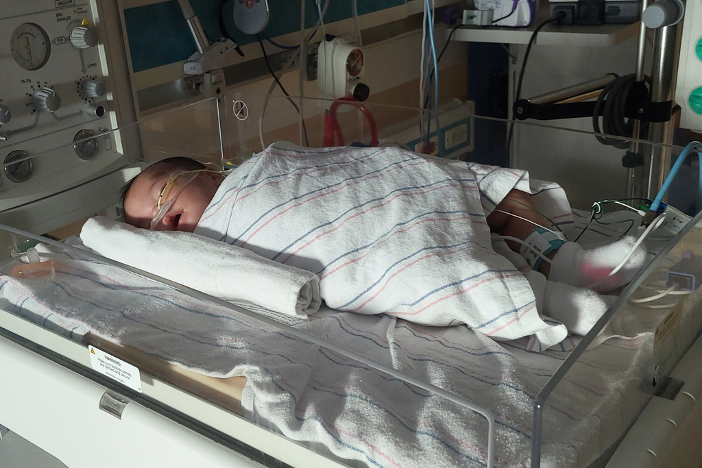 In this photo provided by Stephen Dexter, his 2-month-old daughter Rose Dexter is being treated for infantile botulism at Phoenix Children’s Hospital on Sept. 4, 2025, in Phoenix, Ariz. (Stephen Dexter via AP)