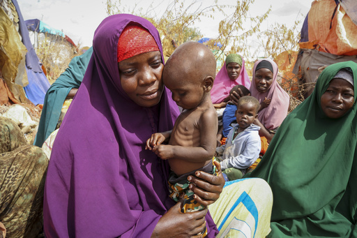 FILE - Nunay Mohamed, 25, who fled the drought-stricken Lower Shabelle area, holds her one-year old malnourished child at a makeshift camp for the displaced on the outskirts of Mogadishu, Somalia on June 30, 2022. A U.N. report says many countries are bouncing back from the COVID-19 pandemic, but the poorest are not and a significant number are seeing conditions in their country deteriorating. But it says development in half of the world&rsquo;s poorest countries remains below 2019 pre-pandemic levels. (AP Photo/Farah Abdi Warsameh, File)