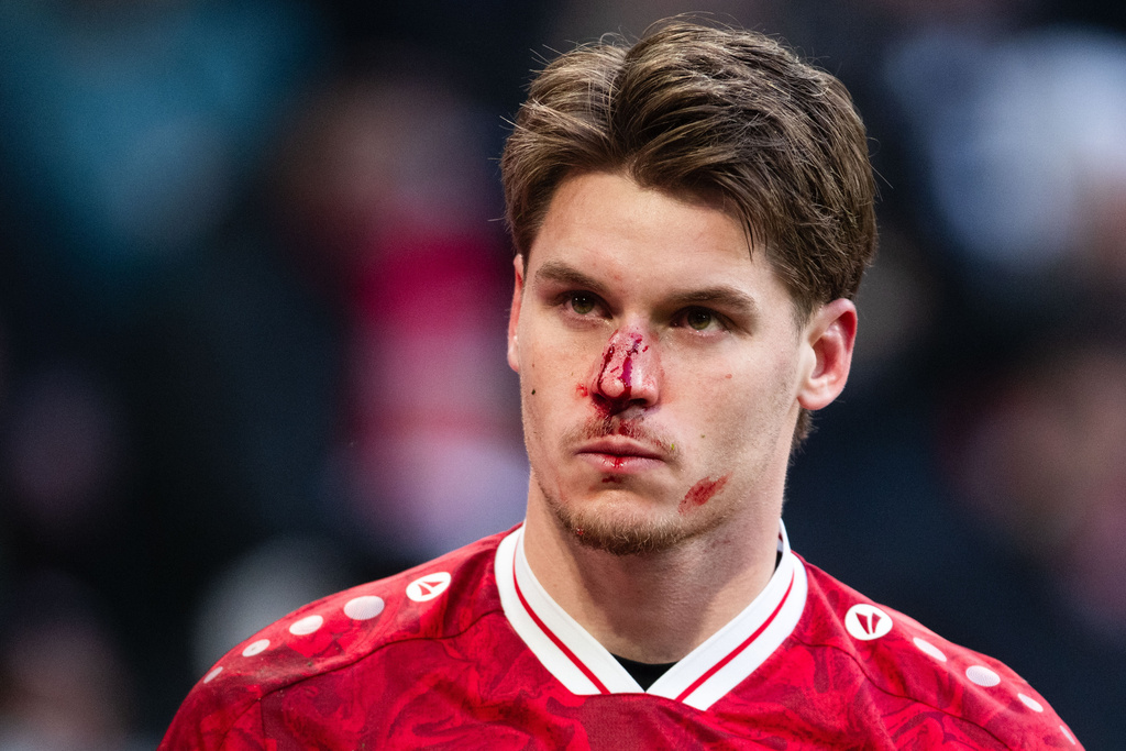 Stuttgart's Ramon Hendriks is seen bleeding during the German Bundesliga soccer match Borussia Moenchengladbach and VfB Stuttgart in Moenchengladbach, Germany, Sunday, Jan. 25, 2026. (Marius Becker/dpa via AP)