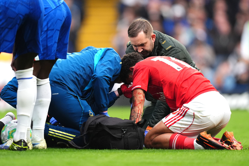 Nottingham Forest's Morgan Gibbs-White receives treatment for a head injury during the English Premier League soccer match between Chelsea and Nottingham Forest in London, Monday, May 4, 2026. (John Walton/PA via AP)