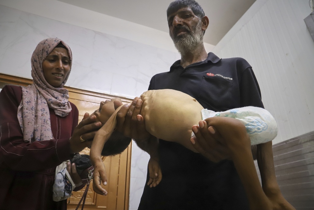 Islam Al-Najjar caresses the body of her 5-year-old nephew, Jamal al-Najjar, as his grandfather, Adnan Al-Najjar, carries him to be prepared for his funeral after he died at Nasser Hospital in Khan Younis, southern Gaza Strip, Tuesday, Aug. 12, 2025. The head of Nasser's pediatrics unit said Jamal, who was born with rickets, died from severe malnutrition. (AP Photo/Mariam Dagga)