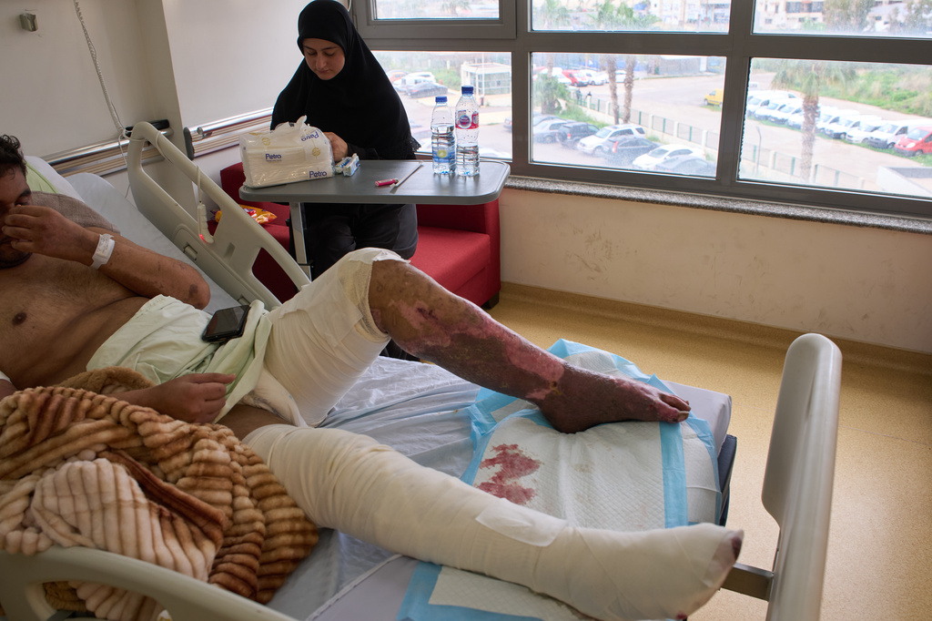 A man with burn wounds from an Israeli airstrike on southern Lebanon lying in bed at the Sidon Government Hospital in Sidon, Lebanon, Thursday, April 2, 2026. (AP Photo/Emilio Morenatti)