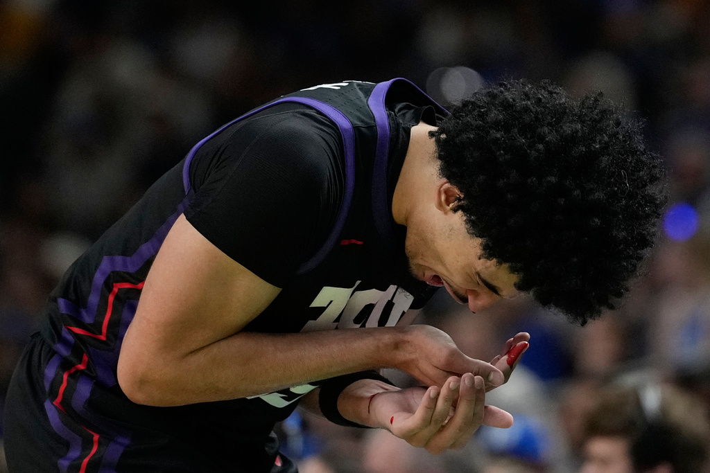 TCU forward David Punch (15) is injured during the first half in the second round of the NCAA college basketball tournament against TCU, Saturday, March 21, 2026, in Greenville, S.C. (AP Photo/Brynn Anderson)