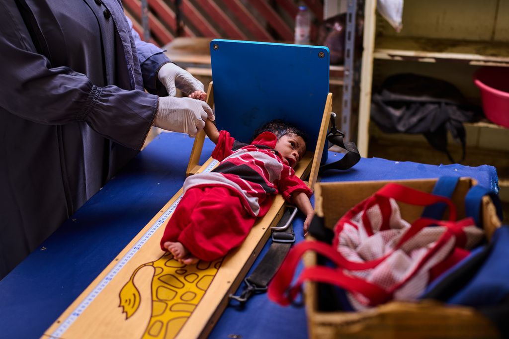 A staff member measures a newly arrived child patient at the paediatric hospital stabilization center in Port Sudan, Sudan, Wednesday, April 15, 2026. (AP Photo/Bernat Armangue)