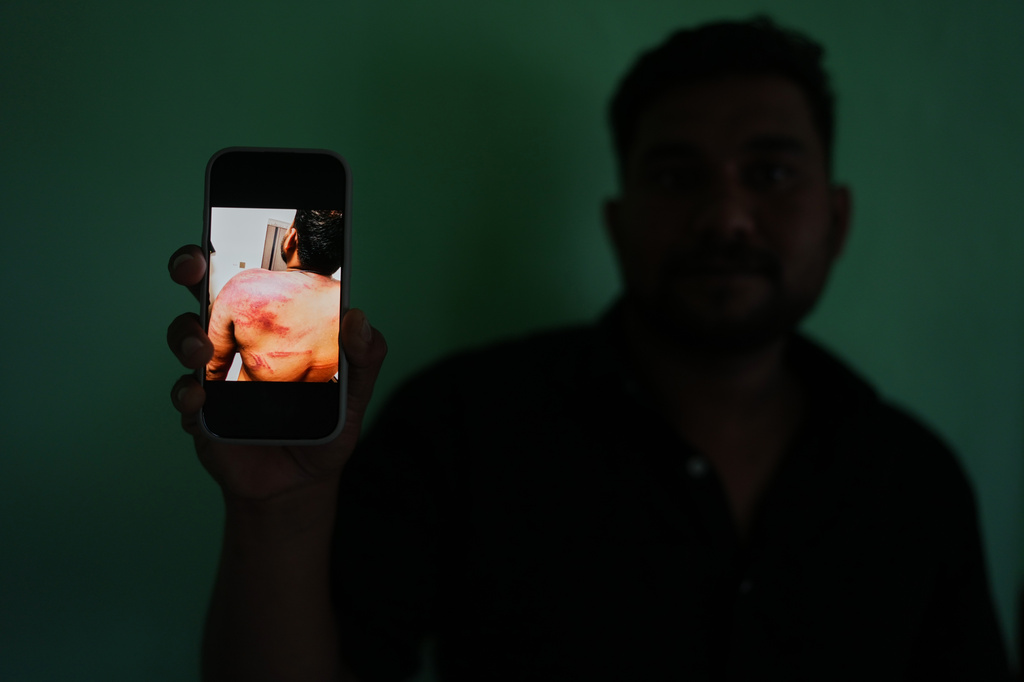 Safeer Mohammed Koorimannil displays a photograph on his mobile phone documenting injuries he said he sustained when his employers at the Tai Chang scam compound in Myanmar, beat him for underperformance in Sulthan Bathery in the southern state of Kerala, India, Thursday, March 12, 2026. (AP Photo/Manish Swarup)