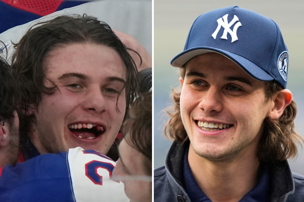FILE - This combo of file photos show hockey player Jack Hughes, left, celebrating after the gold medal game against Canada in Milan, Italy, and at right, at Yankee Stadium sporting a new smile before a New York Yankees baseball game in New York. (AP Photo/File)