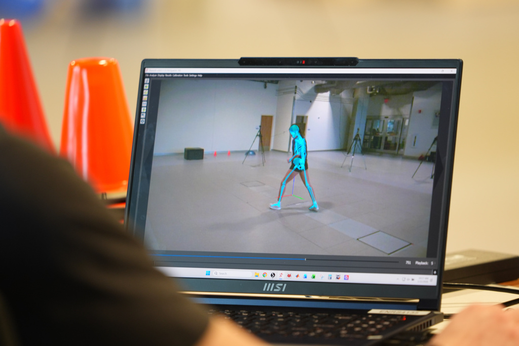 CORRECTS TO TEPICHIN, NOT TEPICHIAN - A skeletal representation of high school soccer player Sofia Tepichin is seen at the Movement Science Laboratory at Scottish Rite for Children in Frisco, Texas, Jan. 22, 2026. (AP Photo/LM Otero)