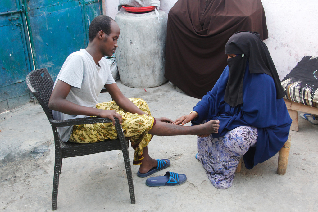 Mohamed Abdi Awale, who says he was captured and tortured by smugglers while attempting to reach Europe, shows his mother wounds during an interview with The Associated Press in Mogadishu, Somalia, Monday, Nov. 17, 2025. (AP Photo/Farah Abdi Warsameh)
