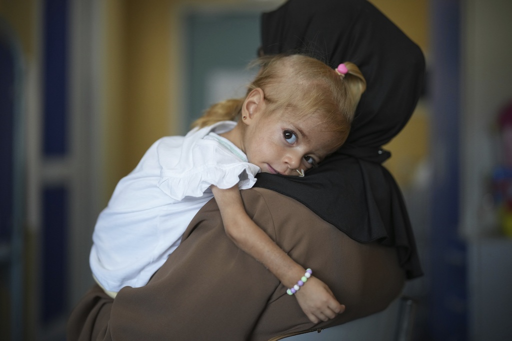 Islam Qudeih holds her daughter, Shamm Qudeih, 2, during an interview with The Associated Press at the Santobono Pausilipon Children's Hospital in Naples, southern Italy, Tuesday, Sept. 2, 2025, where Shamm is being treated after being evacuated from Gaza. (AP Photo/Andrew Medichini)