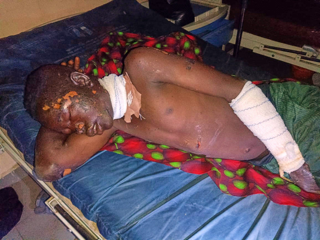 In this photo released by Amnesty International Nigeria, a patient receives treatment at the Yariman Bakura Specialist hospital in Gusau, Nigeria, Monday, May 11, 2026, after a Nigerian military airstrike struck a market on Sunday. (Amnesty International Nigeria Via AP)