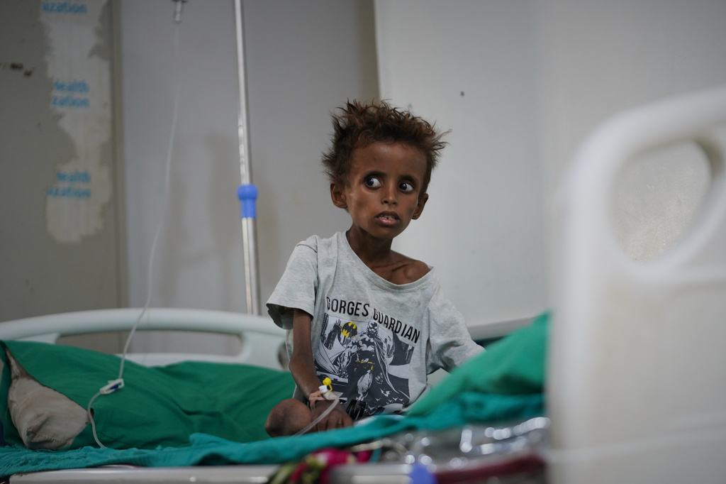 Tarek al-Salami, 7, who was displaced from the city of Mokha and is showing symptoms of malnutrition, sits on a bed while receiving treatment at a therapeutic feeding center in Buraiqa, on the western outskirts of Aden, Yemen, Tuesday, Sept. 22, 2026. (AP Photo/Abdulnasser Alseddik)