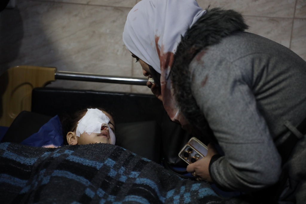Kafaa Abu Sheikh, right, the mother of Syrian girl Fatima al-Zahra, 4, checks on her daughter who was wounded when clashes broke out between Syrian government forces and Kurdish fighters in a contested area of the northern city of Aleppo, Syria, Tuesday, Jan. 6, 2026. (AP Photo/Omar Albam)