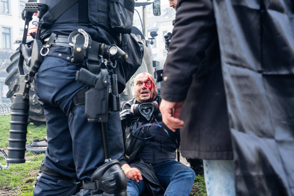 A protestor sits on a curb injured during a demonstration of European farmers near the European Parliament in Brussels, Thursday, Dec. 18, 2025. (AP Photo/Marius Burgelman)