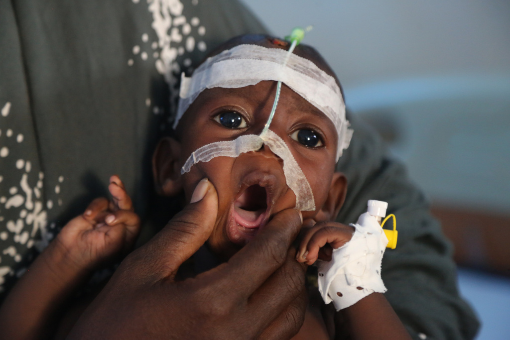 A mother sits with her malnourished baby at Banadir Hospital in Mogadishu, Somalia, Tuesday, Nov. 11, 2025. (AP Photo/Farah Abdi Warsameh)