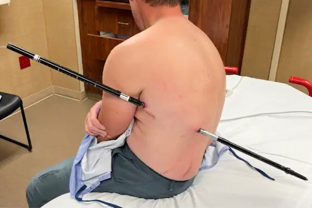 This photo provided by David Cifaldi shows Cifaldi while he was being treated Monday, July 20, 2026, at St. Vincent Regional Hospital in Billings, Mont. (Jessee Ross via AP)
