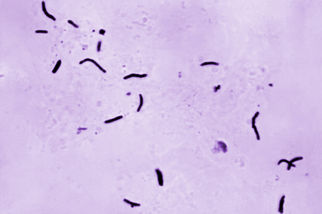 FILE - This 1966 microscope photo provided by the U.S. Centers for Disease Control and Prevention shows Mycobacterium tuberculosis bacilli, the organism responsible for causing the disease tuberculosis. (Elizabeth S. Mingioli/CDC via AP)