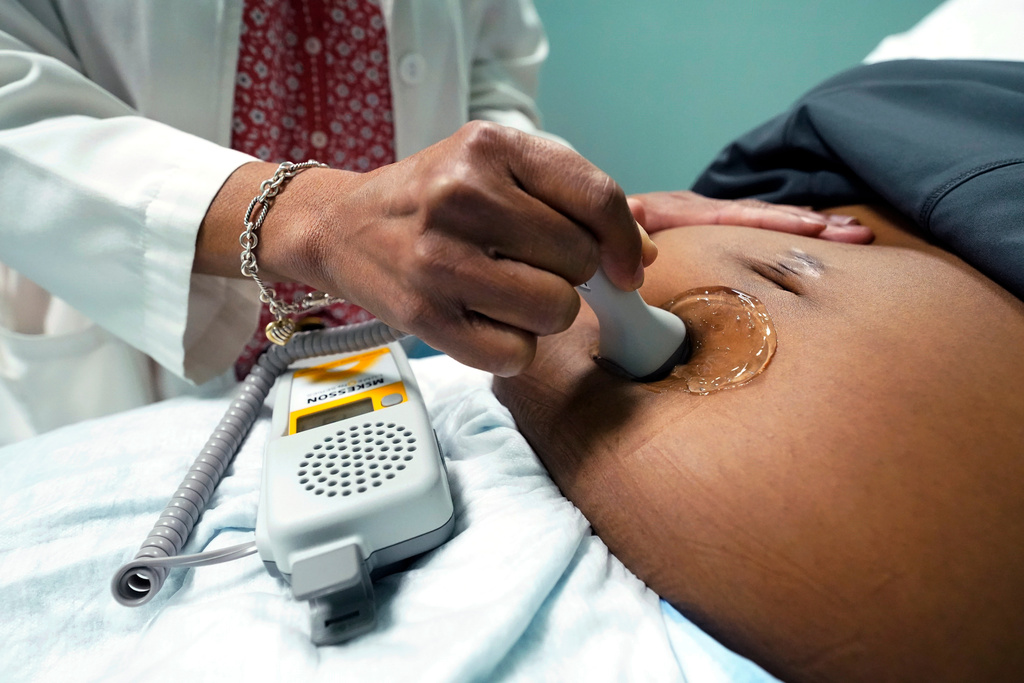 FILE - A doctor uses a hand-held Doppler probe on a pregnant woman to measure the heartbeat of the fetus, Dec. 17, 2021, in Jackson, Miss. (AP Photo/Rogelio V. Solis, File)
