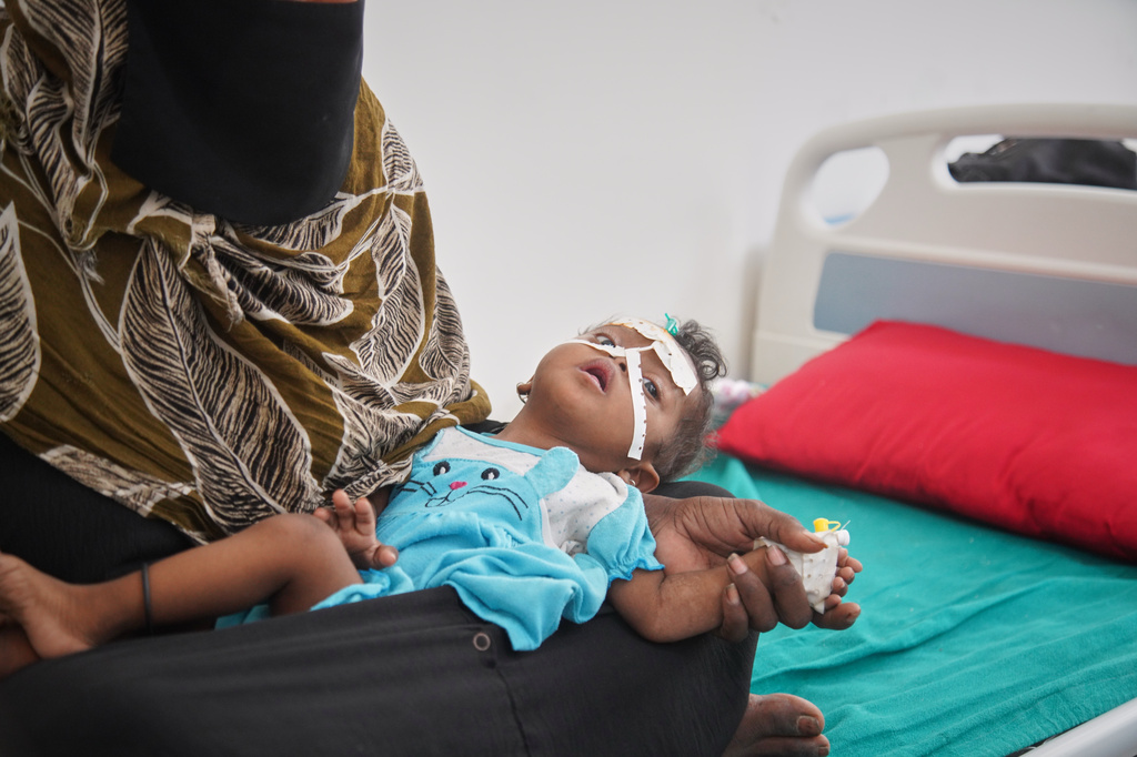 A woman holds a child showing symptoms of malnutrition while the child receives treatment at a therapeutic feeding center in Buraiqa, on the western outskirts of Aden, Yemen, Tuesday, Sept. 22, 2026. (AP Photo/Abdulnasser Alseddik)